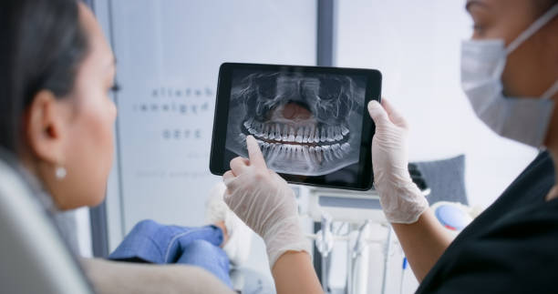 Licensed Dental Implants service in Rancho Alegre, TX - Smile Center Dentistry