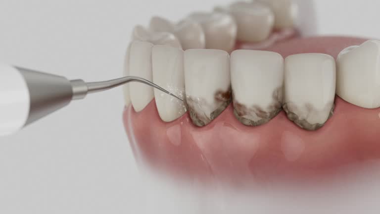 Reliable Dental Implants contractor in Rancho Alegre, TX by Smile Center Dentistry